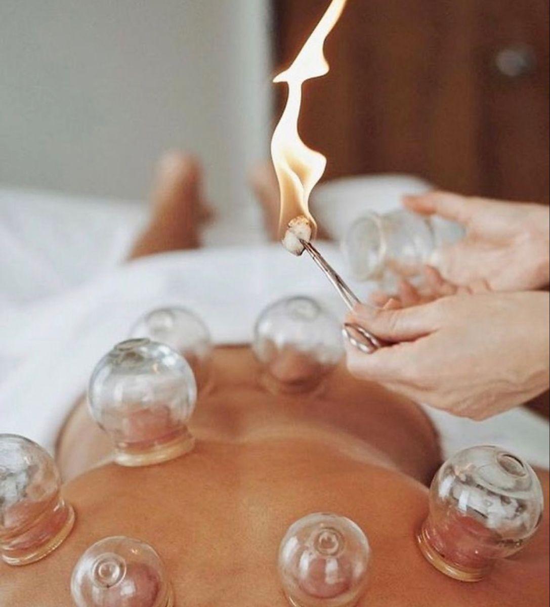 Cupping